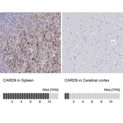 CARD9 Antibody, Novus Biologicals:Antibodies:Primary Antibodies